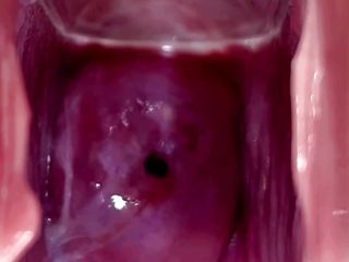 Cervix Throbbing And Flowing Oozing Cum During Close Up Speculum Play free video