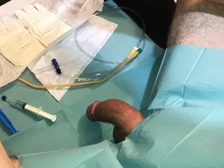 First Time Painful Catheter Insertion Peehole Cumshot free video